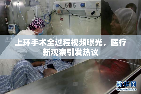 上环手术全过程视频曝光，医疗新观察引发热议