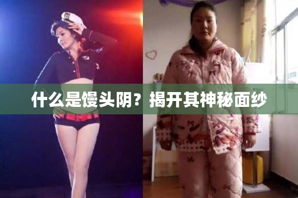 什么是馒头阴？揭开其神秘面纱