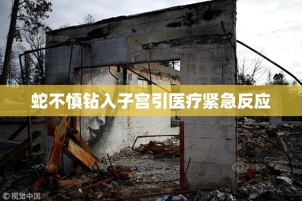 蛇不慎钻入子宫引医疗紧急反应