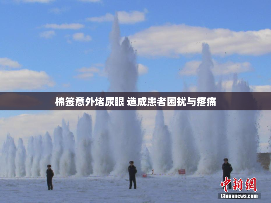 棉签意外堵尿眼 造成患者困扰与疼痛