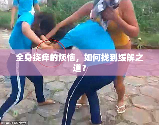 全身挠痒的烦恼，如何找到缓解之道？