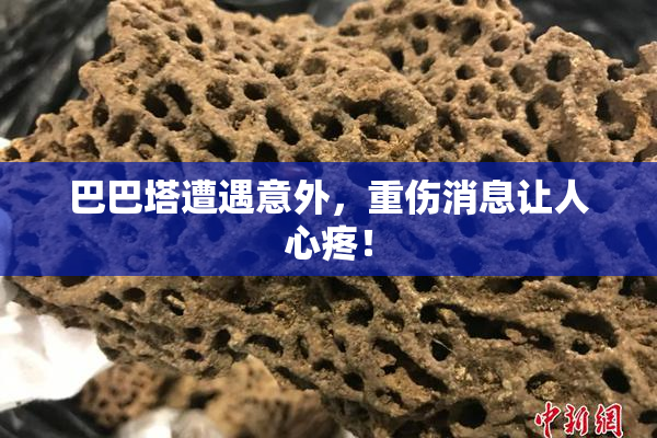 巴巴塔遭遇意外，重伤消息让人心疼！