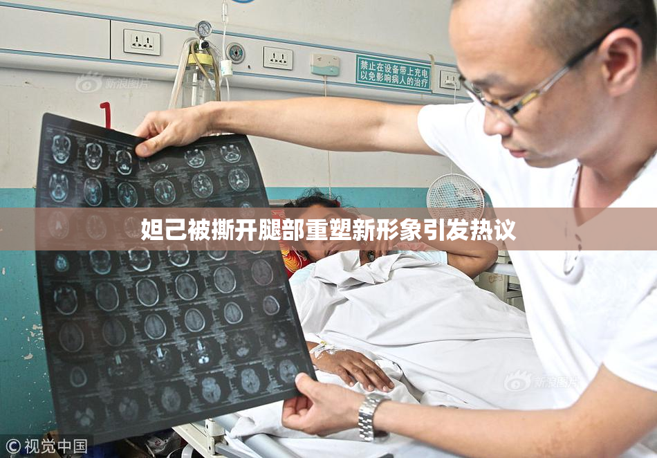 妲己被撕开腿部重塑新形象引发热议