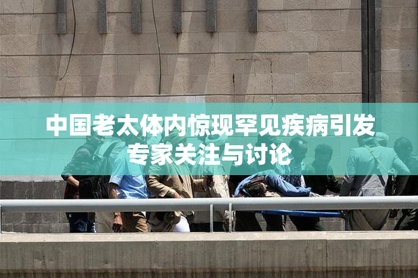 中国老太体内惊现罕见疾病引发专家关注与讨论