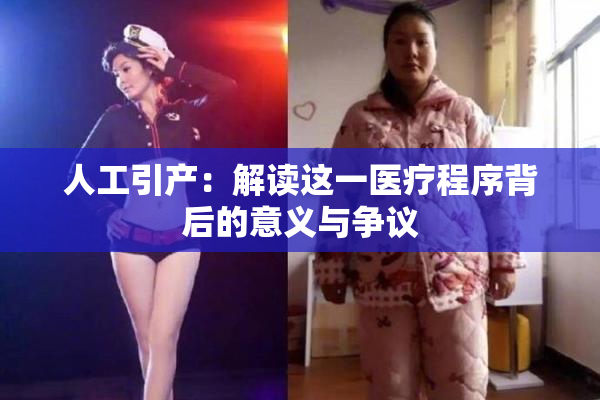 人工引产：解读这一医疗程序背后的意义与争议