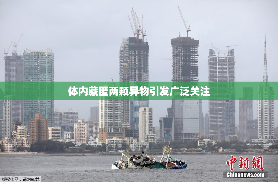 体内藏匿两颗异物引发广泛关注