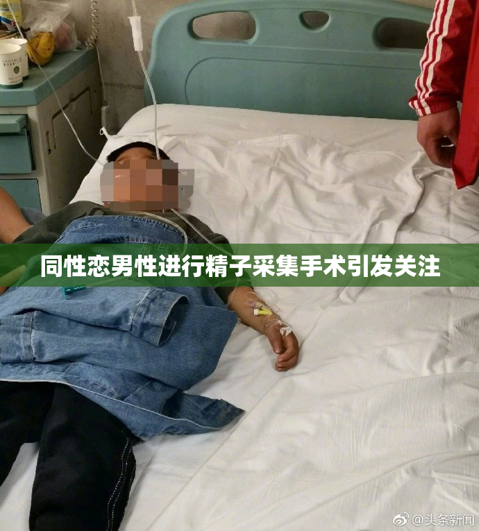 同性恋男性进行精子采集手术引发关注