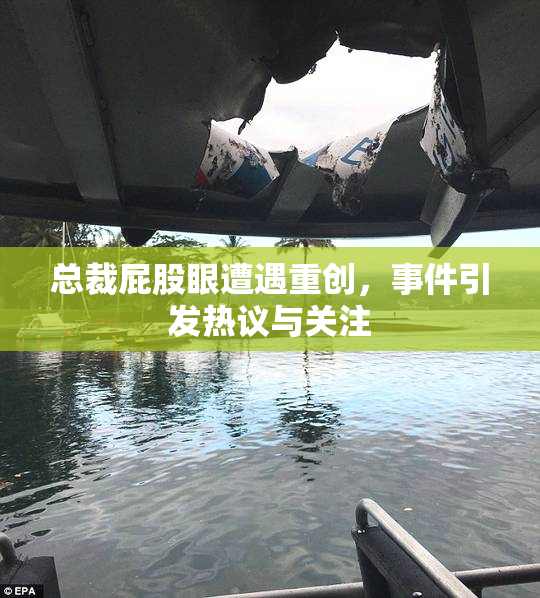 总裁屁股眼遭遇重创，事件引发热议与关注