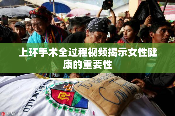 上环手术全过程视频揭示女性健康的重要性