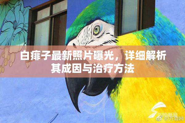 白痱子最新照片曝光，详细解析其成因与治疗方法