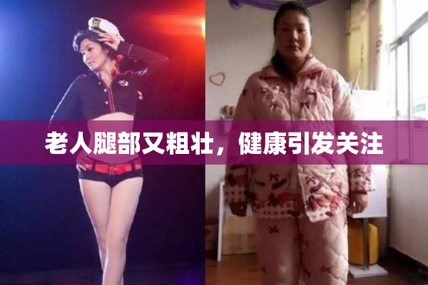 老人腿部又粗壮，健康引发关注