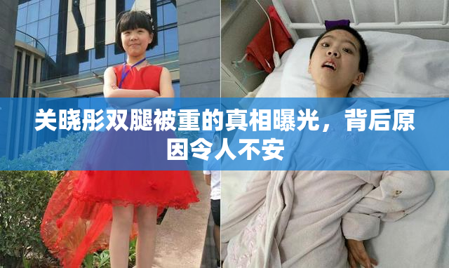 关晓彤双腿被重的真相曝光，背后原因令人不安