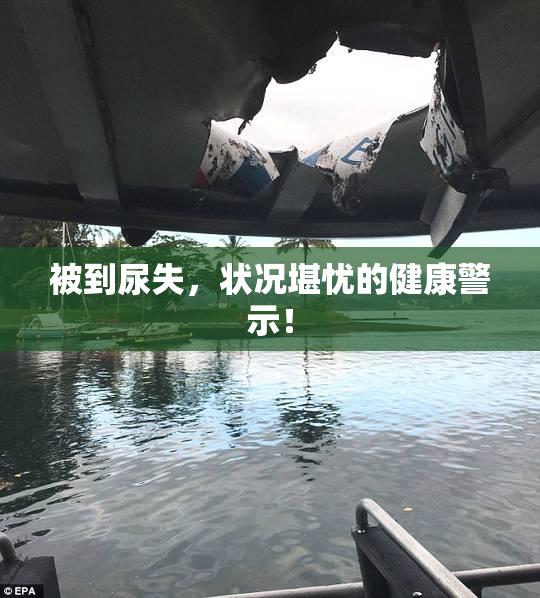 被到尿失，状况堪忧的健康警示！