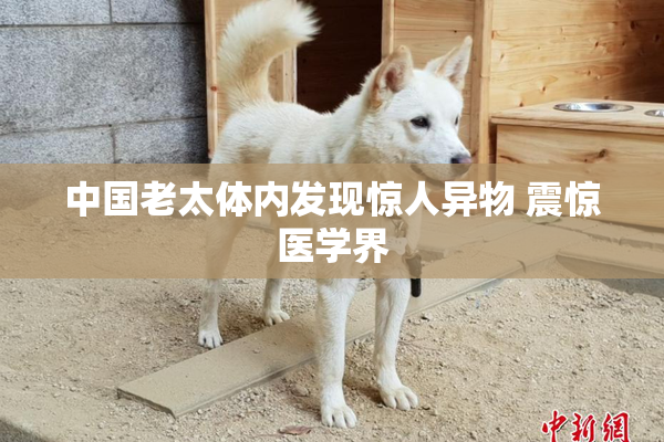 中国老太体内发现惊人异物 震惊医学界